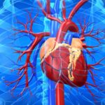 problemas caridovasculares