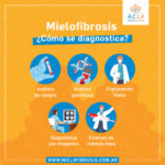 mielofibrosis0